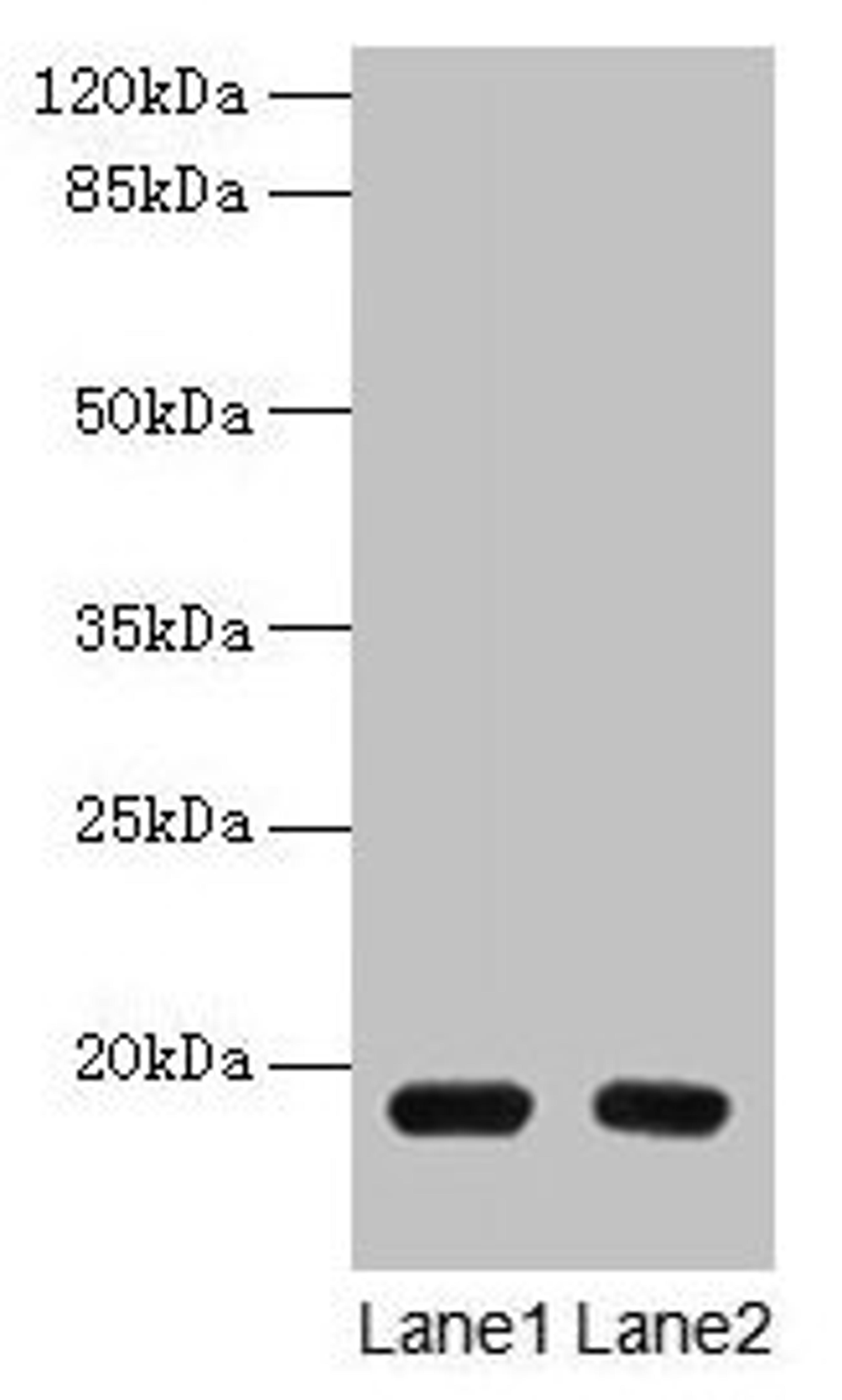 Western blot. All lanes: PDE6D antibody at 1.5µg/ml. Lane 1: A549 whole cell lysate. Lane 2: MCF-7 whole cell lysate. Secondary. Goat polyclonal to rabbit IgG at 1/10000 dilution. Predicted band size: 18 kDa. Observed band size: 18 kDa