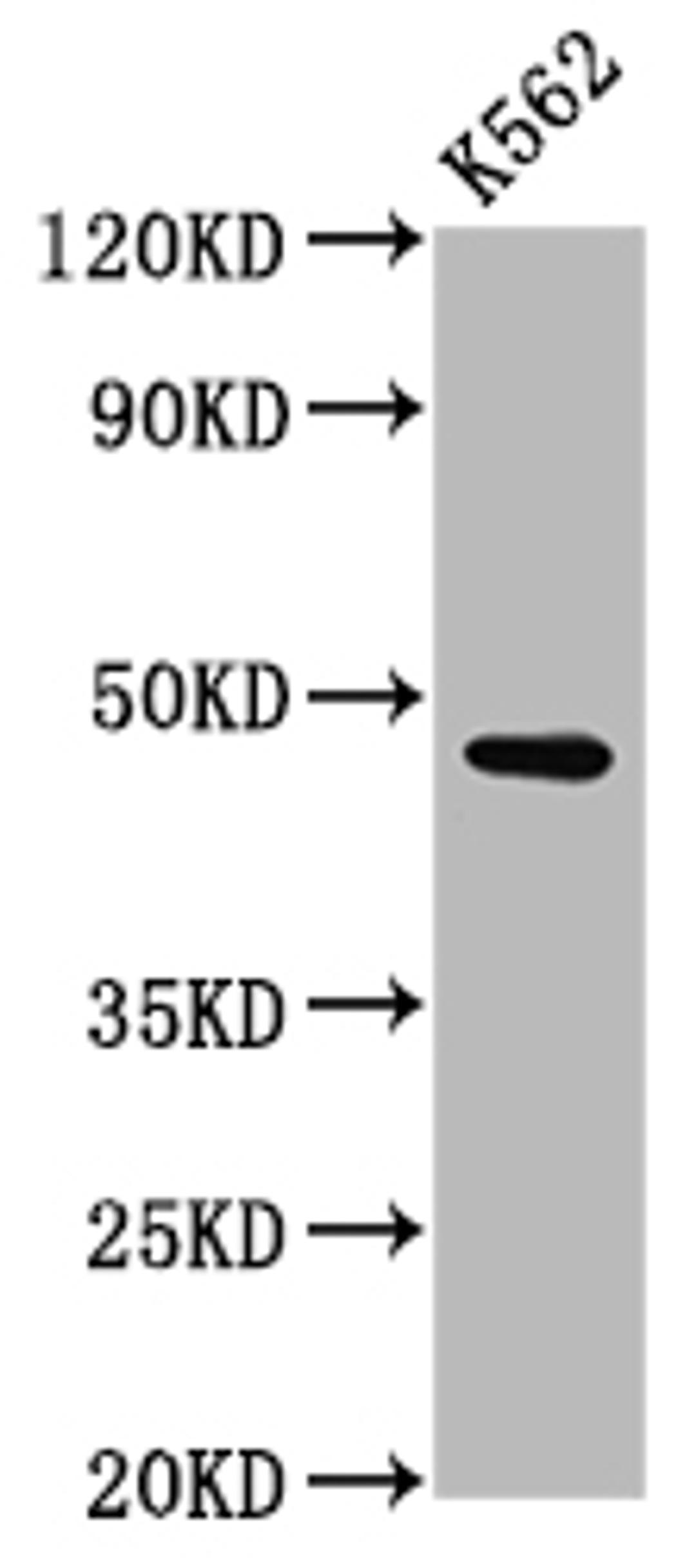 Western Blot. Positive WB detected in: K562 whole cell lysate. All lanes: BROX antibody at 3µg/ml. Secondary. Goat polyclonal to rabbit IgG at 1/50000 dilution. Predicted band size: 47, 43 kDa. Observed band size: 47 kDa
