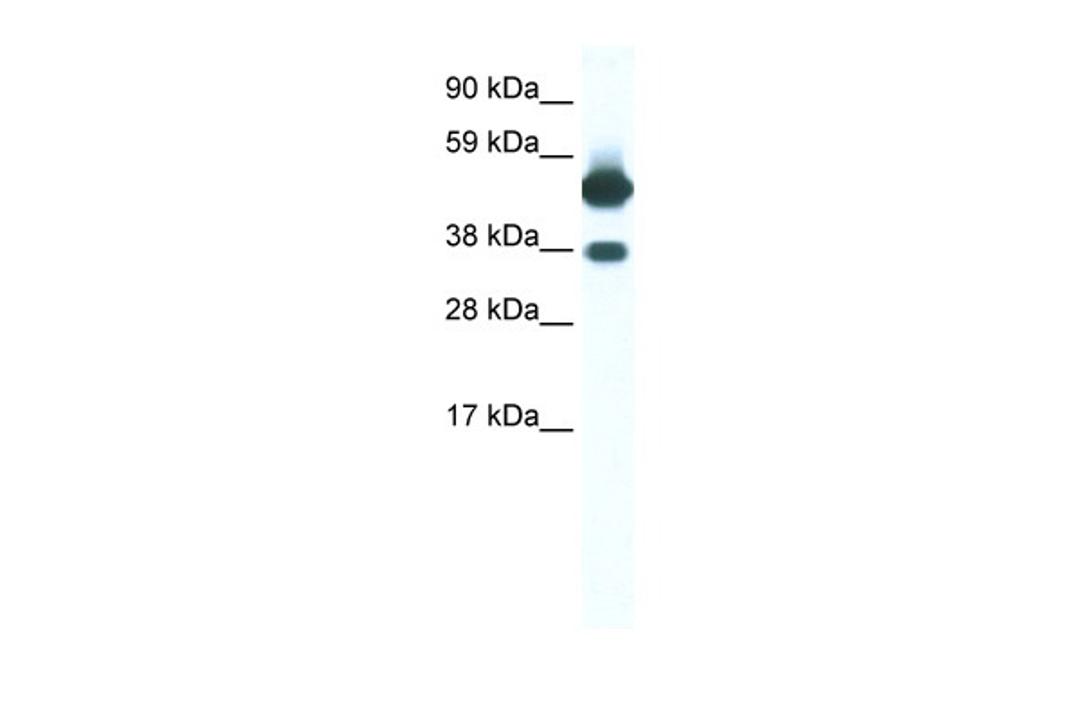 Antibody used in WB on Human Muscle at 0.2-1 ug/ml.