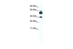 Antibody used in WB on Human Muscle at 0.2-1 ug/ml.