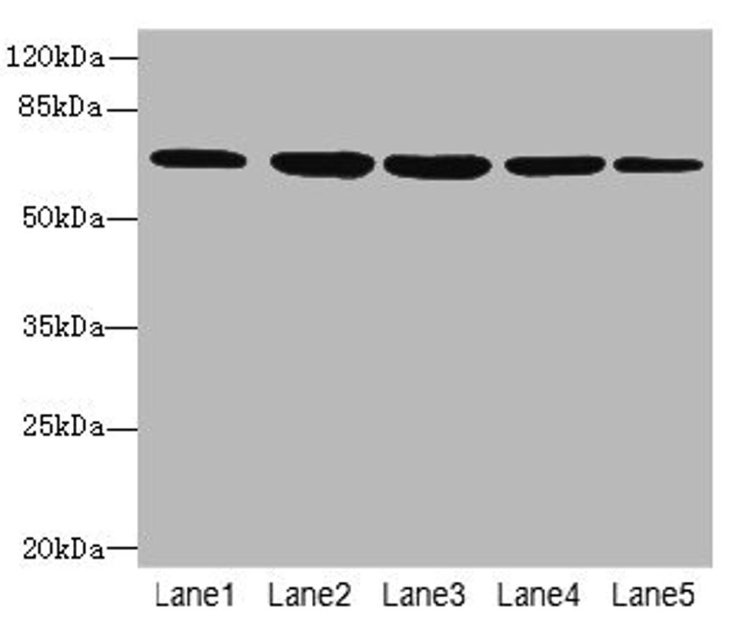 Western blot. All lanes: ILVBL antibody at 4µg/ml. Lane 1: HepG2 whole cell lysate. Lane 2: Hela whole cell lysate. Lane 3: A549 whole cell lysate. Lane 4: Jurkat whole cell lysate. Lane 5: U87 whole cell lysate. Secondary. Goat polyclonal to rabbit IgG at 1/10000 dilution. Predicted band size: 68 kDa. Observed band size: 68 kDa