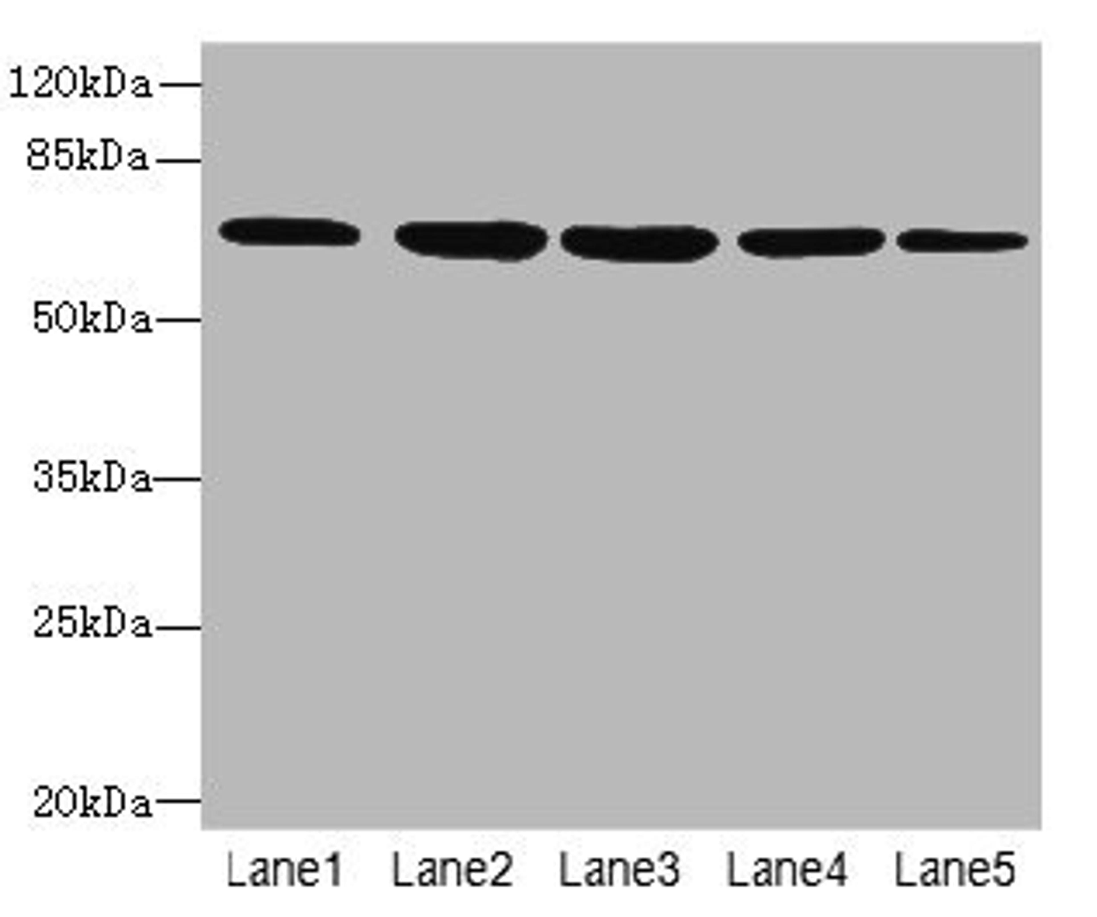 Western blot. All lanes: ILVBL antibody at 4µg/ml. Lane 1: HepG2 whole cell lysate. Lane 2: Hela whole cell lysate. Lane 3: A549 whole cell lysate. Lane 4: Jurkat whole cell lysate. Lane 5: U87 whole cell lysate. Secondary. Goat polyclonal to rabbit IgG at 1/10000 dilution. Predicted band size: 68 kDa. Observed band size: 68 kDa