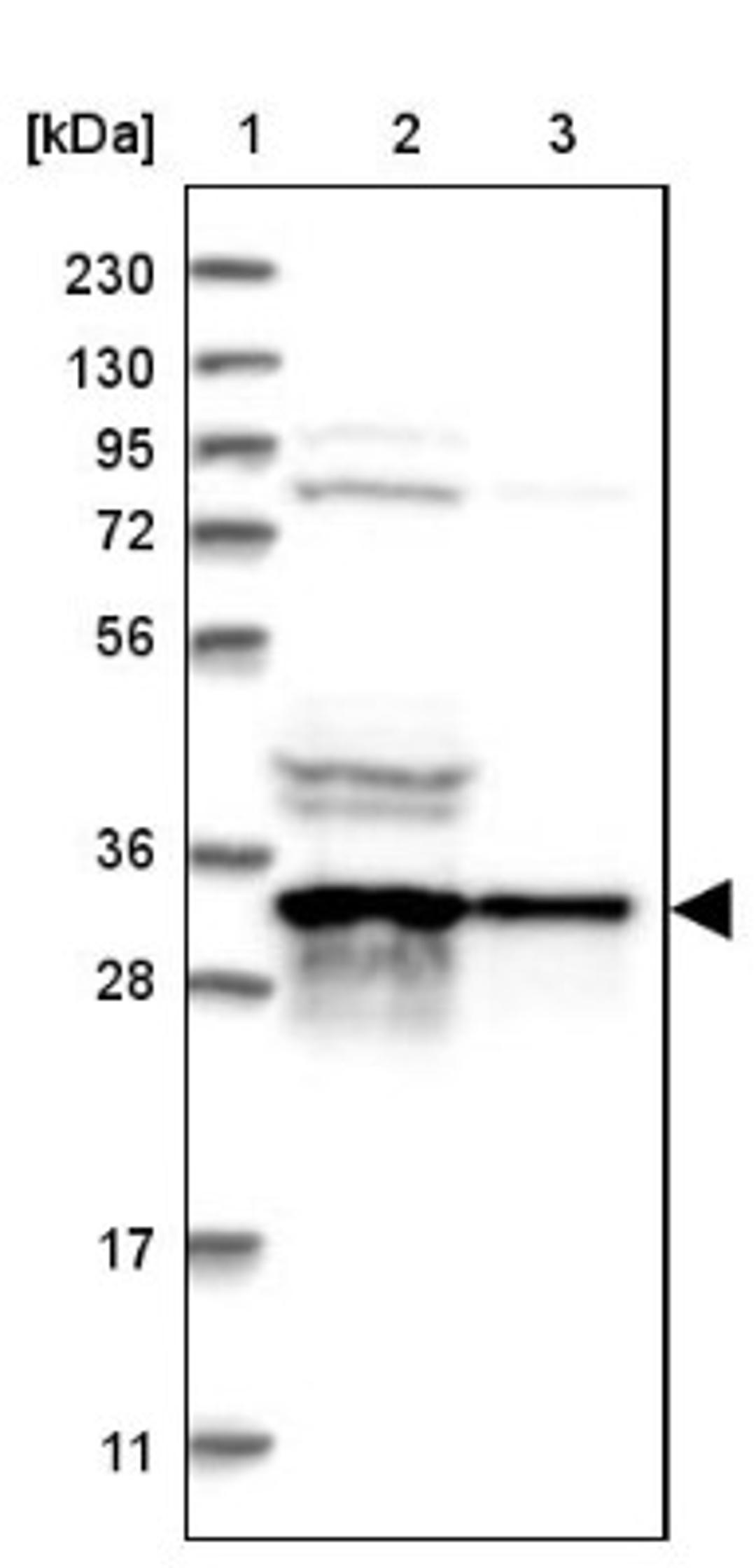 Western Blot: ATP6V1D Antibody [NBP1-88895] - Lane 1: Marker [kDa] 230, 130, 95, 72, 56, 36, 28, 17, 11<br/>Lane 2: Human cell line RT-4<br/>Lane 3: Human cell line U-251MG sp