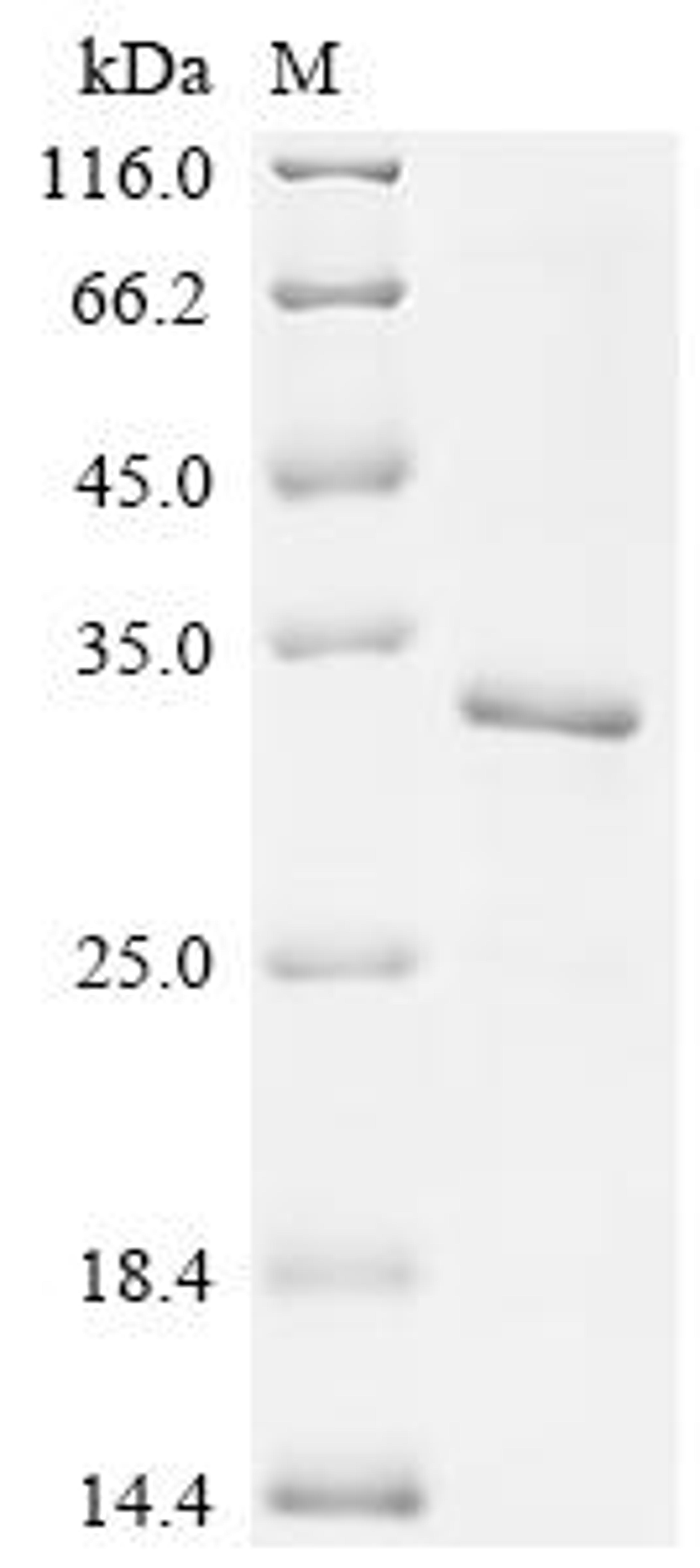 (Tris-Glycine gel) Discontinuous SDS-PAGE (reduced) with 5% enrichment gel and 15% separation gel.