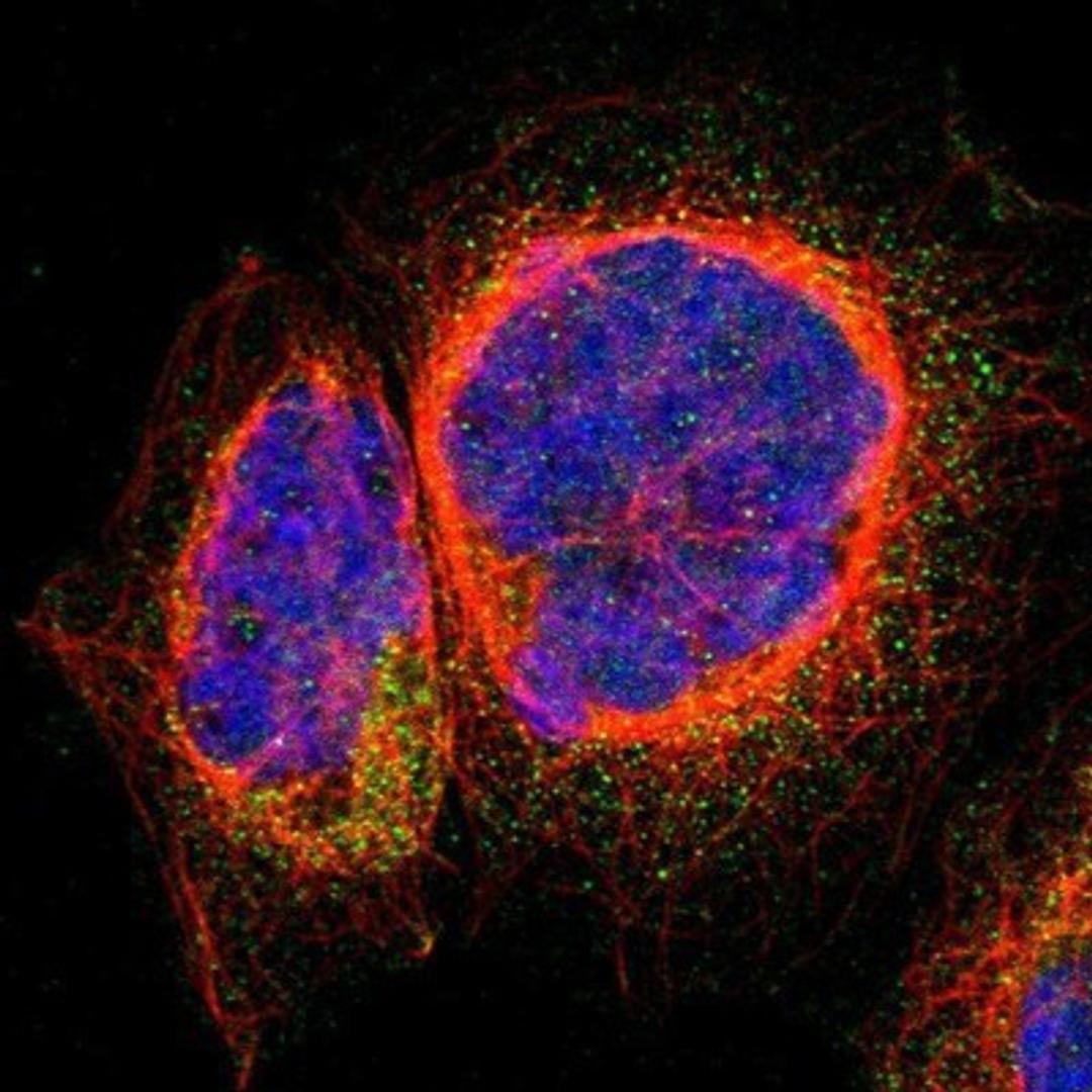 Immunocytochemistry/Immunofluorescence: ARFGAP3 Antibody [NBP1-88842] - Staining of human cell line A-431 shows positivity in cytoplasm.