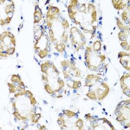 Immunohistochemical staining of human gastric tissue using ST6GAL1 antibody (dilution of 1:100)