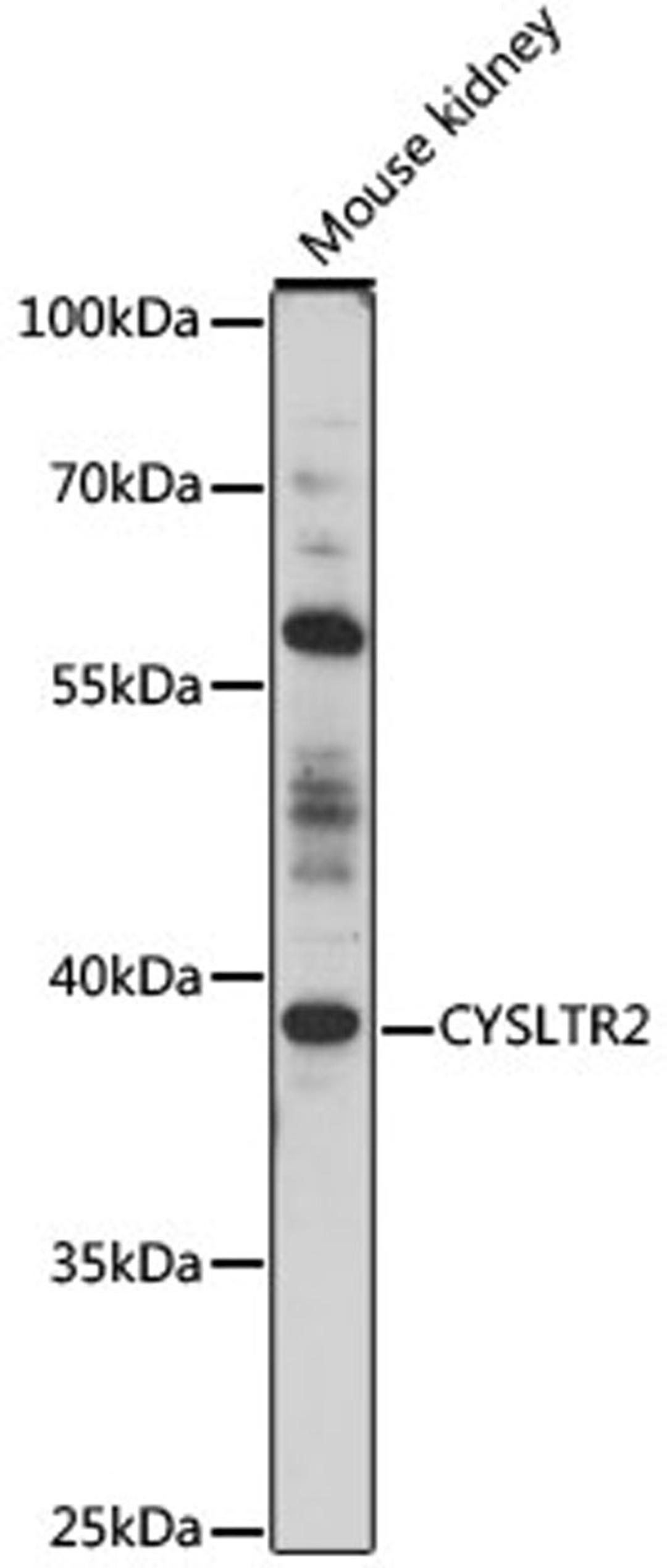 Western blot - CYSLTR2 antibody (A16556)