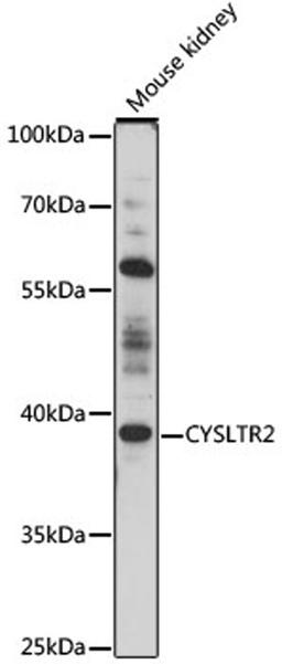 Western blot - CYSLTR2 antibody (A16556)