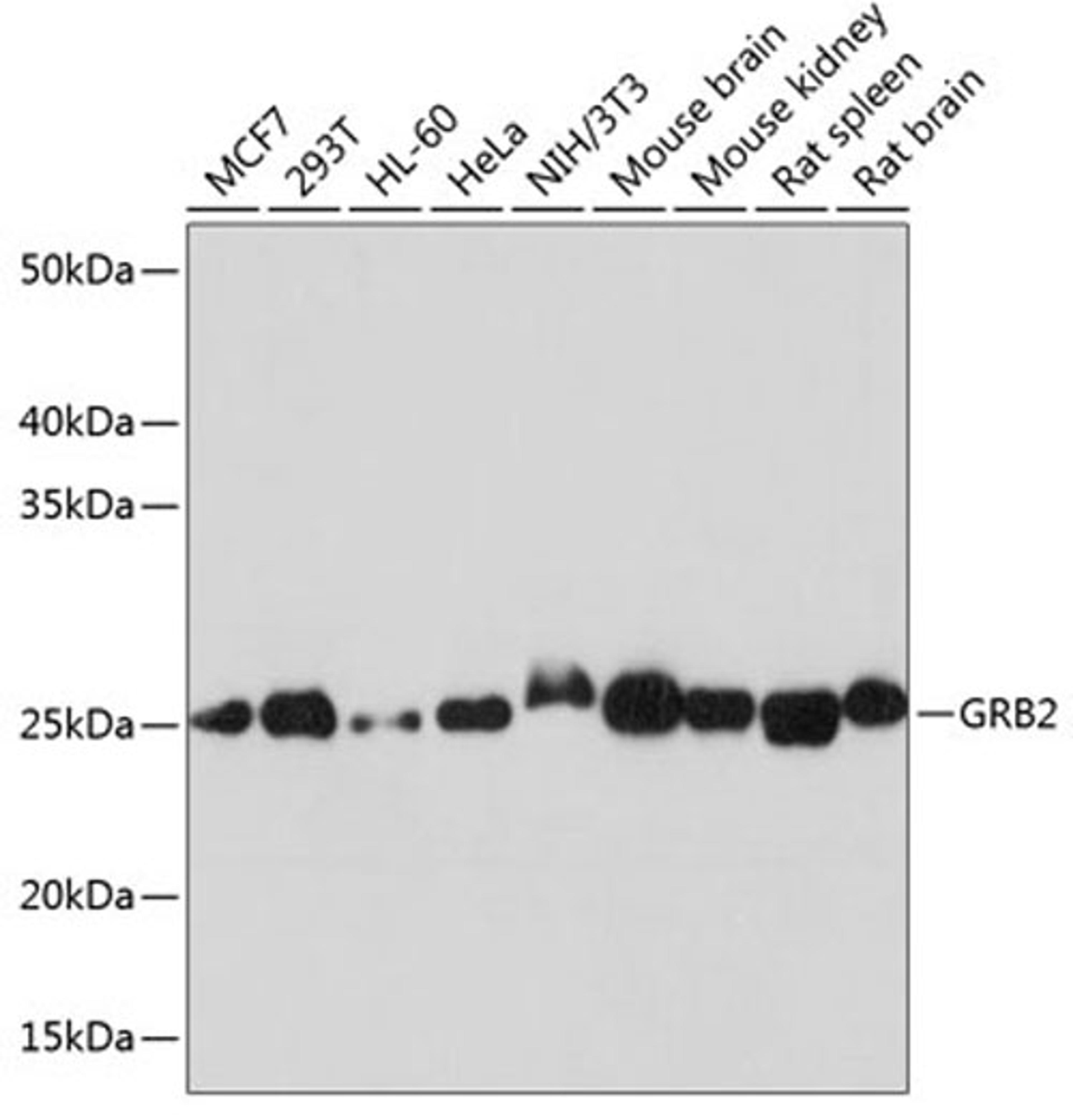 Western blot - GRB2 antibody (A19059)