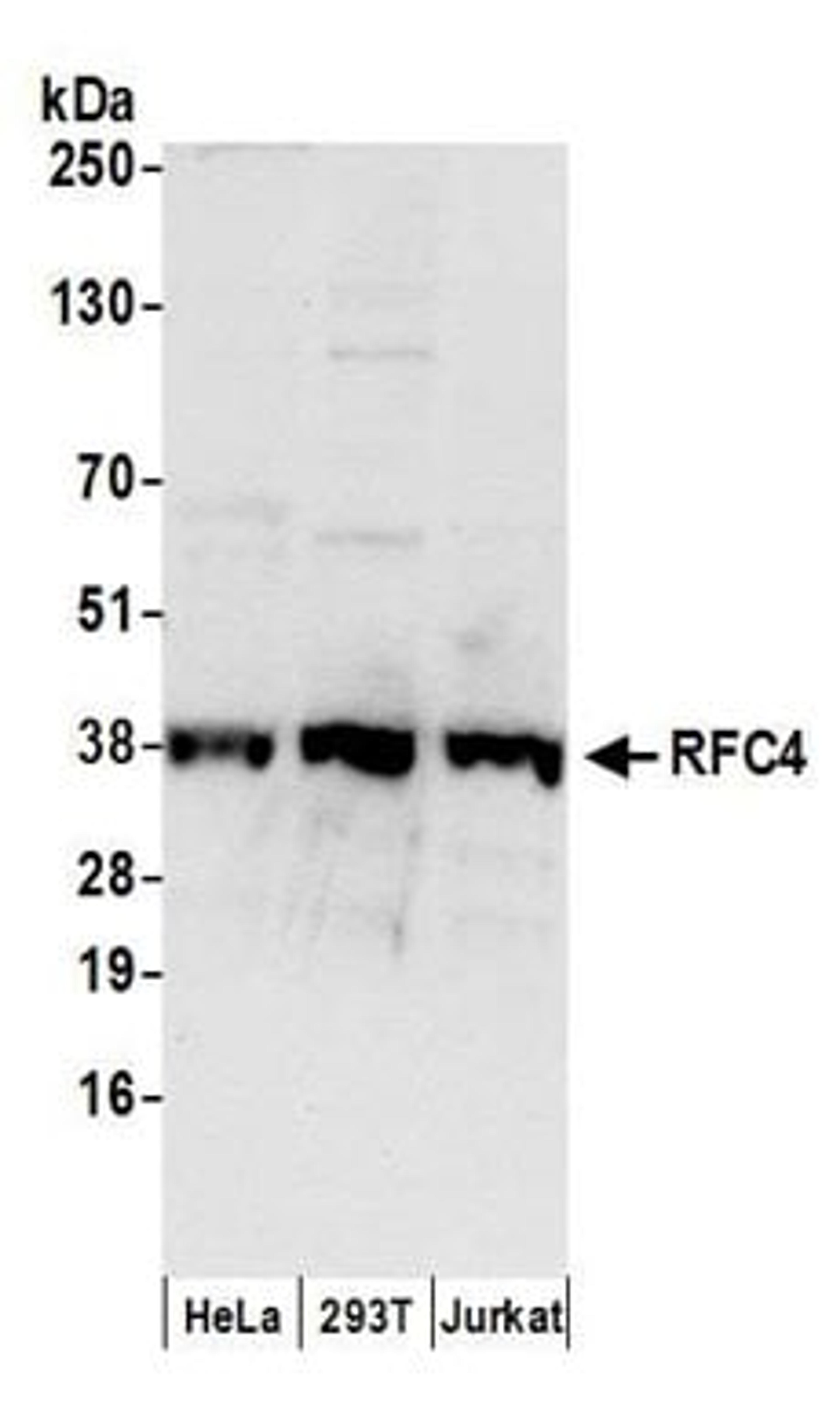 Detection of human RFC4 by western blot.