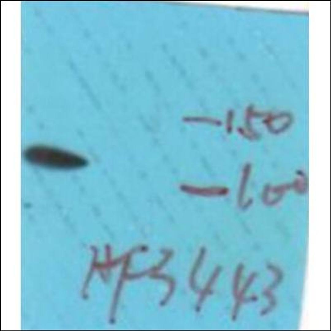 Western blot analysis of HepG2 whole cell lysates using PkD1/PkCmicro -Phospho-Tyr463- antibody