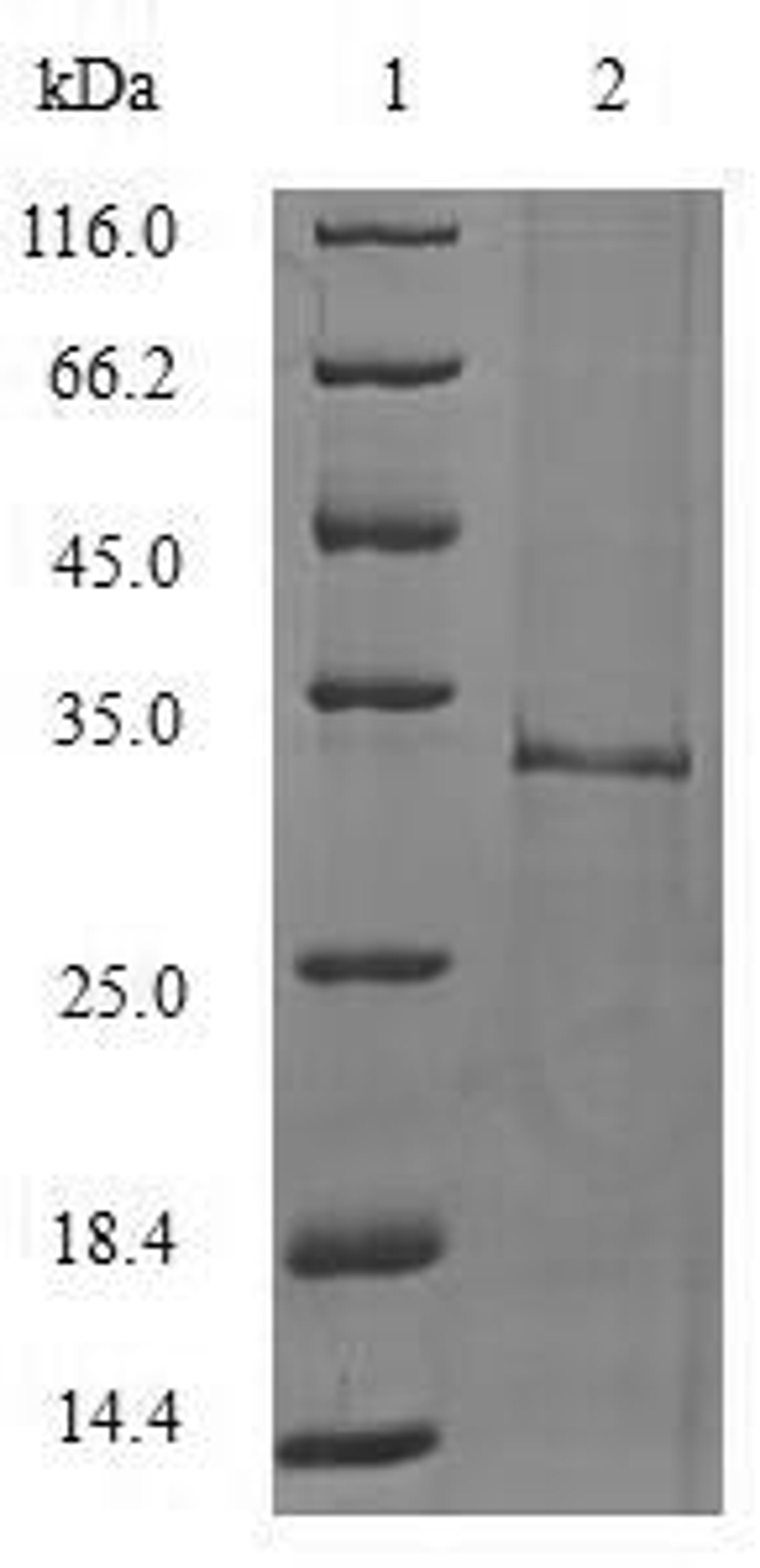 (Tris-Glycine gel) Discontinuous SDS-PAGE (reduced) with 5% enrichment gel and 15% separation gel.