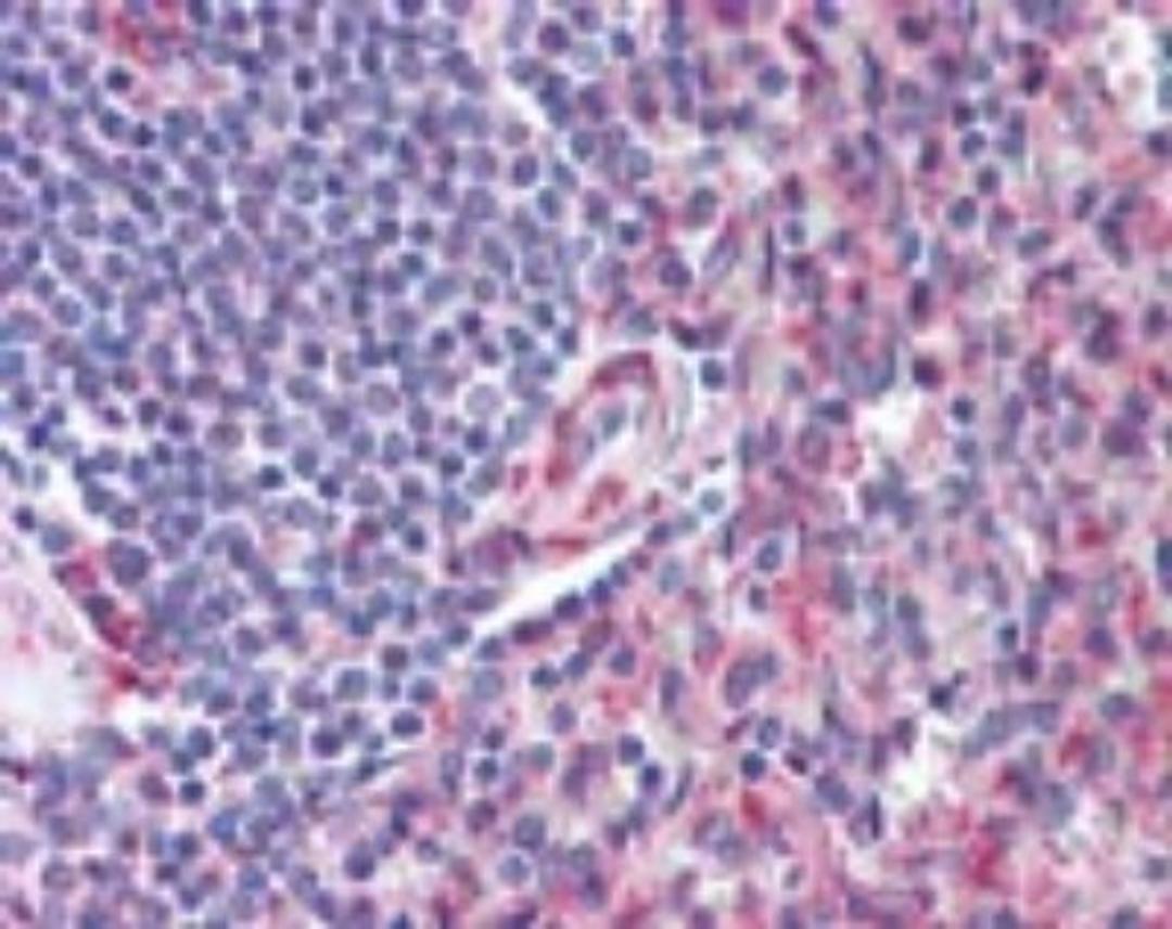 Immunohistochemistry-Paraffin: CD97 Antibody [NBP2-24552] - IHC analysis of human spleen using NBP2-24552 at 10 ug/ml.