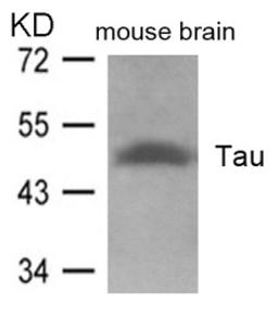 Western blot analysis of lysed extracts from mouse brain tissue using Tau (Ab-262).