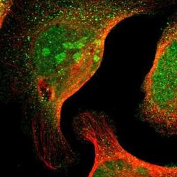 Immunocytochemistry/Immunofluorescence: MED27 Antibody [NBP1-84377] - Staining of human cell line U-2 OS shows positivity in nucleus, nucleoli & cytoplasm.