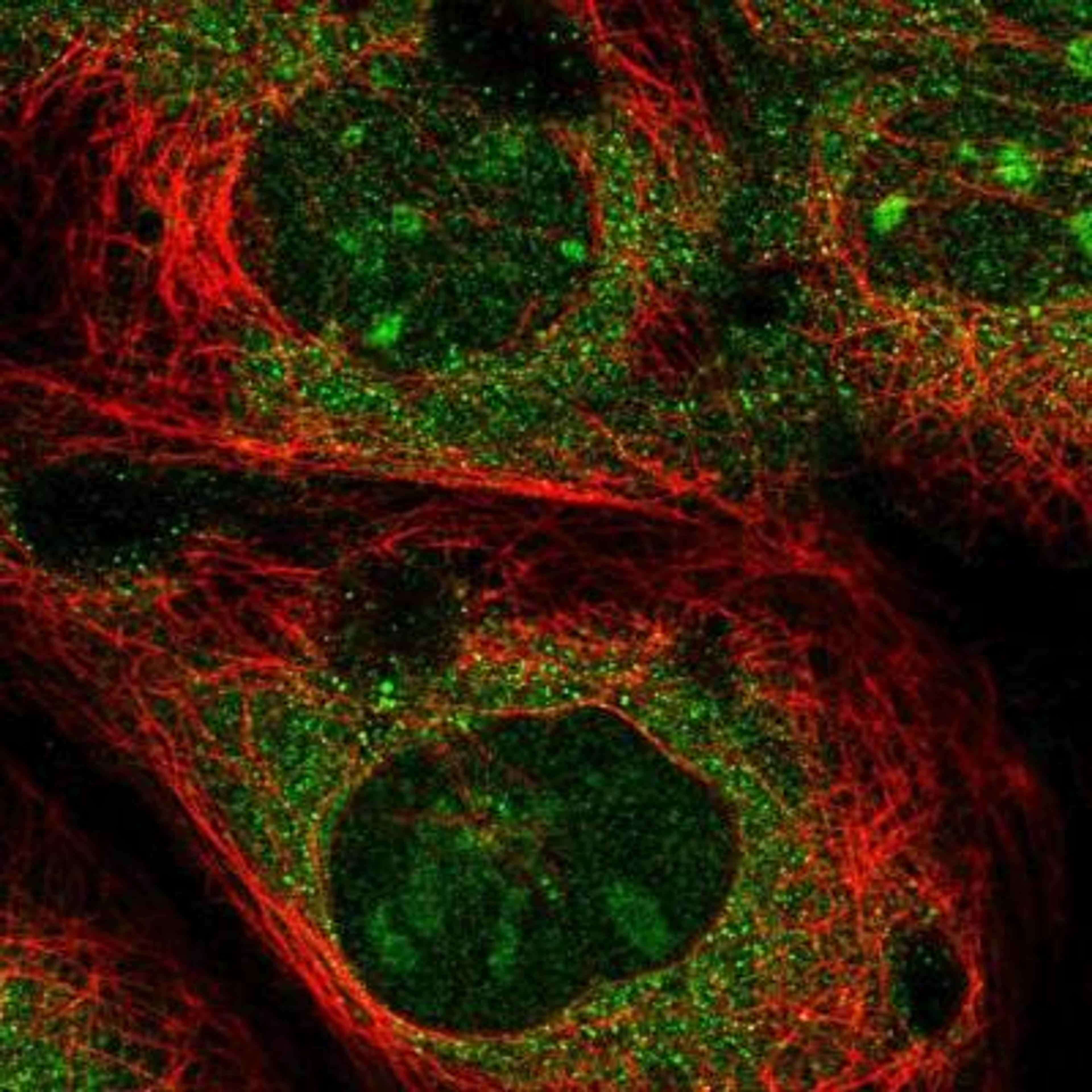 Immunocytochemistry/Immunofluorescence: MGA Antibody [NBP1-94031] - Staining of human cell line A-431 shows positivity in nucleoli & cytoplasm.