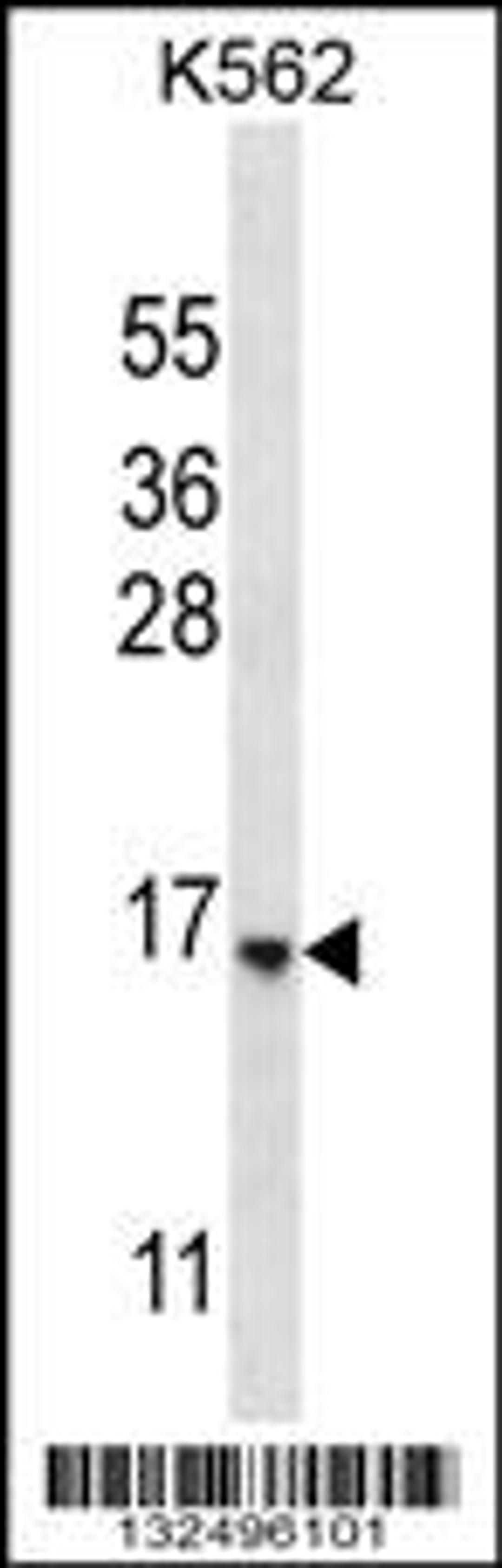 Western blot analysis in K562 cell line lysates (35ug/lane).