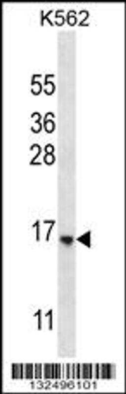 Western blot analysis in K562 cell line lysates (35ug/lane).