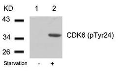 Western blot analysis of lysed extracts from 293 cells untreated (Lane 1) or treated with starvation (lane 2) using CDK6 (phospho-Tyr24).