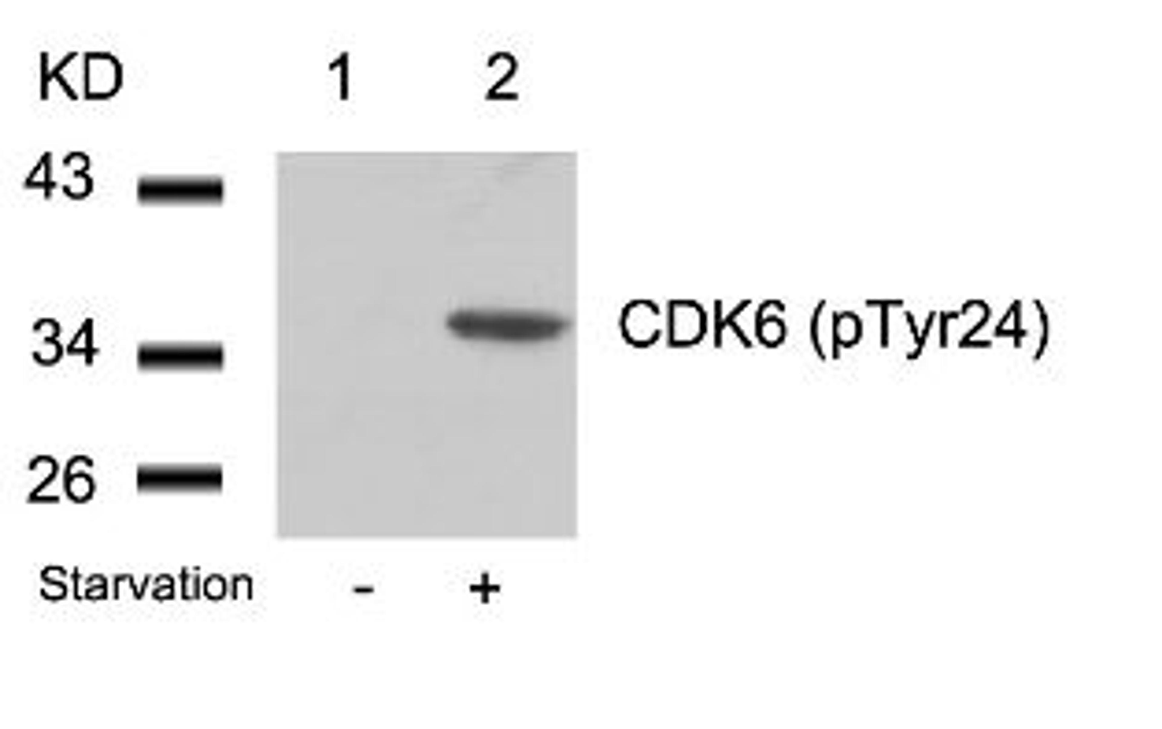 Western blot analysis of lysed extracts from 293 cells untreated (Lane 1) or treated with starvation (lane 2) using CDK6 (phospho-Tyr24).