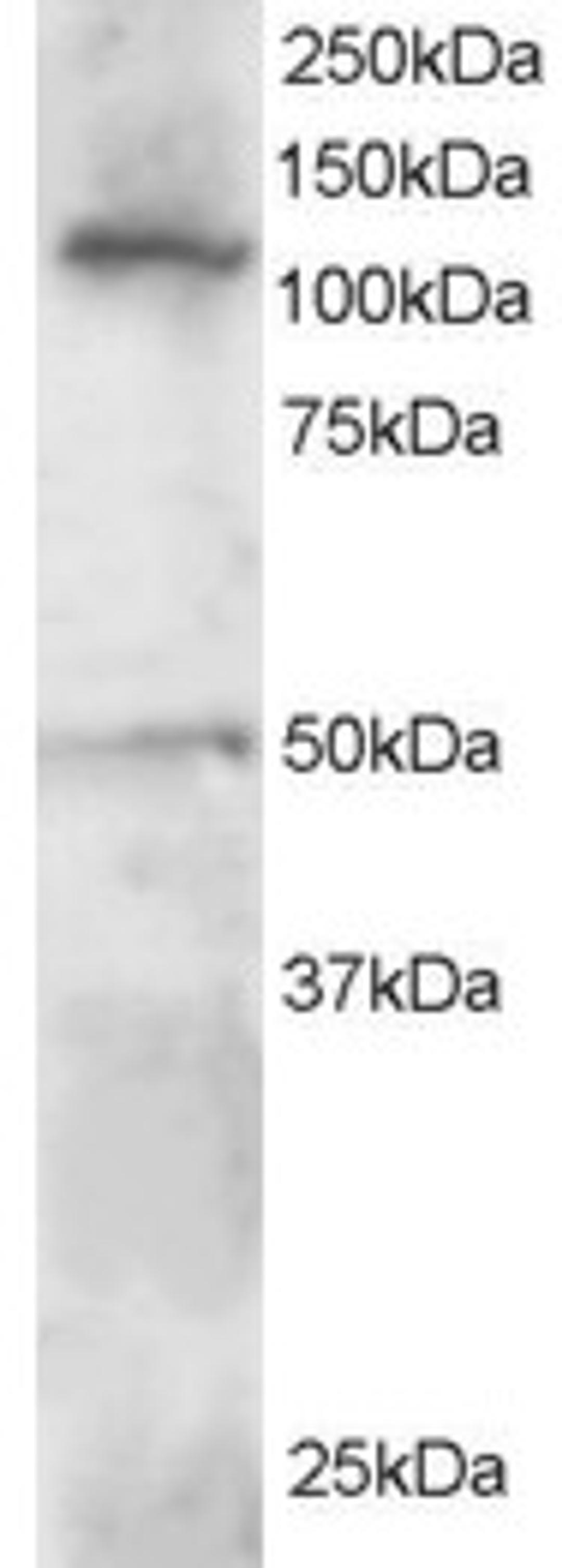 46-385 staining (0.5ug/ml) of Jurkat lysate (RIPA buffer, 30ug total protein per lane). Primary incubated for 1 hour. Detected by western blot using chemiluminescence.