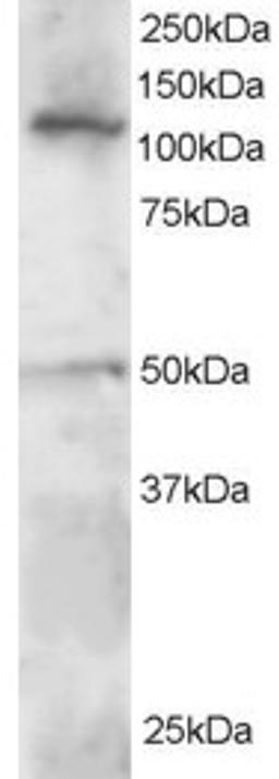 46-385 staining (0.5ug/ml) of Jurkat lysate (RIPA buffer, 30ug total protein per lane). Primary incubated for 1 hour. Detected by western blot using chemiluminescence.