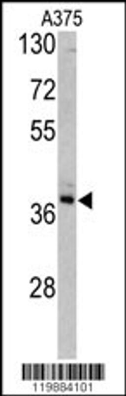 Western blot analysis of TALDO1 antibody in A375 cell line lysates (35ug/lane)