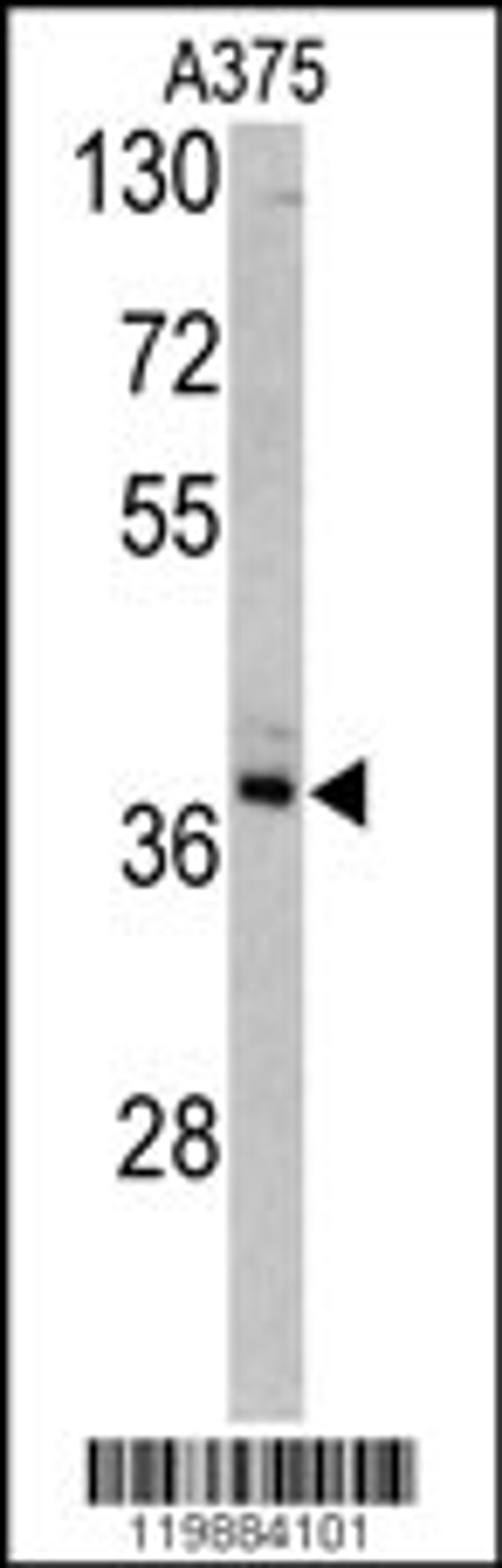 Western blot analysis of TALDO1 antibody in A375 cell line lysates (35ug/lane)