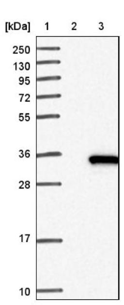 Western Blot: HSD17B14 Antibody [NBP1-85220] - Lane 1: Marker [kDa] 250, 130, 95, 72, 55, 36, 28, 17, 10<br/>Lane 2: Negative control (vector only transfected HEK293T lysate)<br/>Lane 3: Over-expression lysate (Co-expressed with a C-terminal myc-DDK tag (~3.1 kDa) in mammalian HEK293T cells, LY414089)