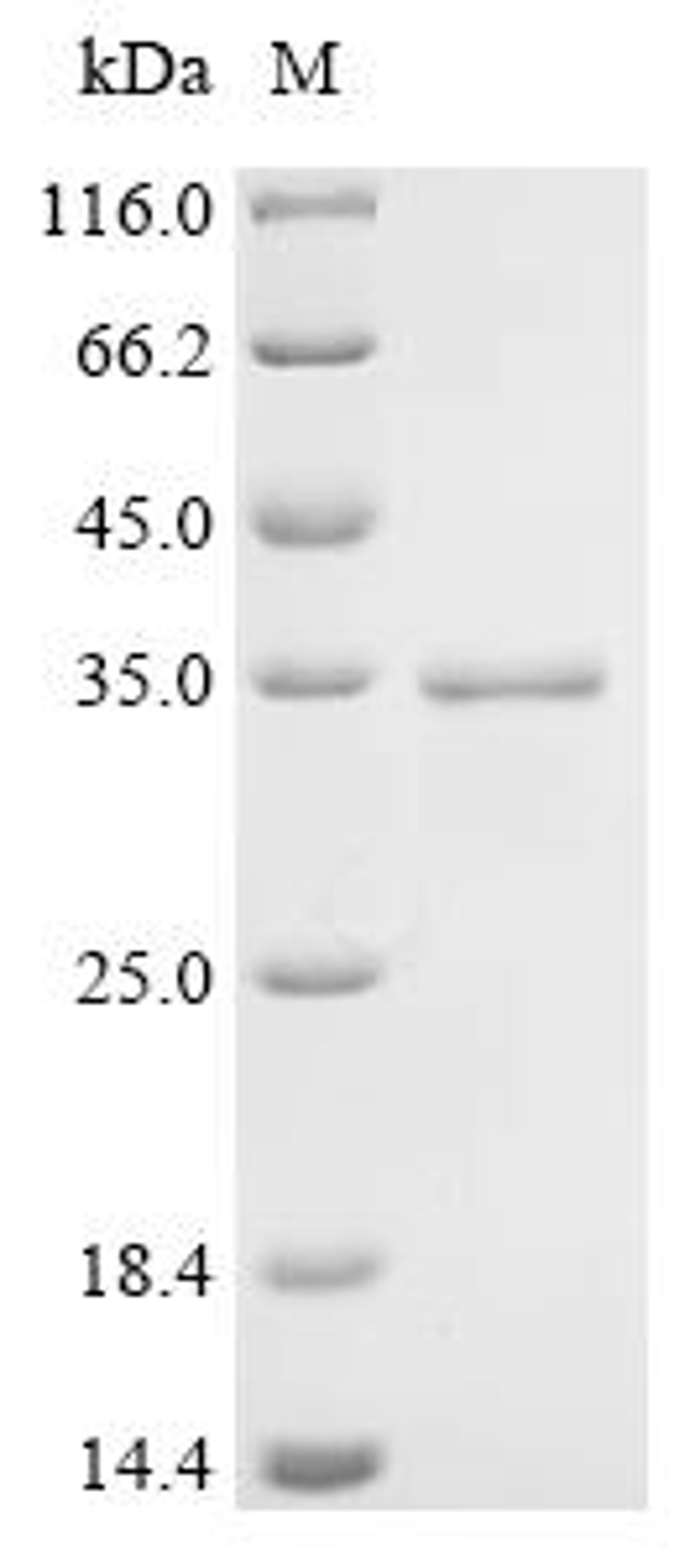 (Tris-Glycine gel) Discontinuous SDS-PAGE (reduced) with 5% enrichment gel and 15% separation gel.