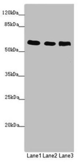 Western blot. All lanes: PRPF4 antibody at 2.87µg/ml. Lane 1: Jurkat whole cell lysate. Lane 2: Hela whole cell lysate. Lane 3: HepG2 whole cell lysate. Secondary. Goat polyclonal to rabbit IgG at 1/10000 dilution. Predicted band size: 59 kDa. Observed band size: 59 kDa