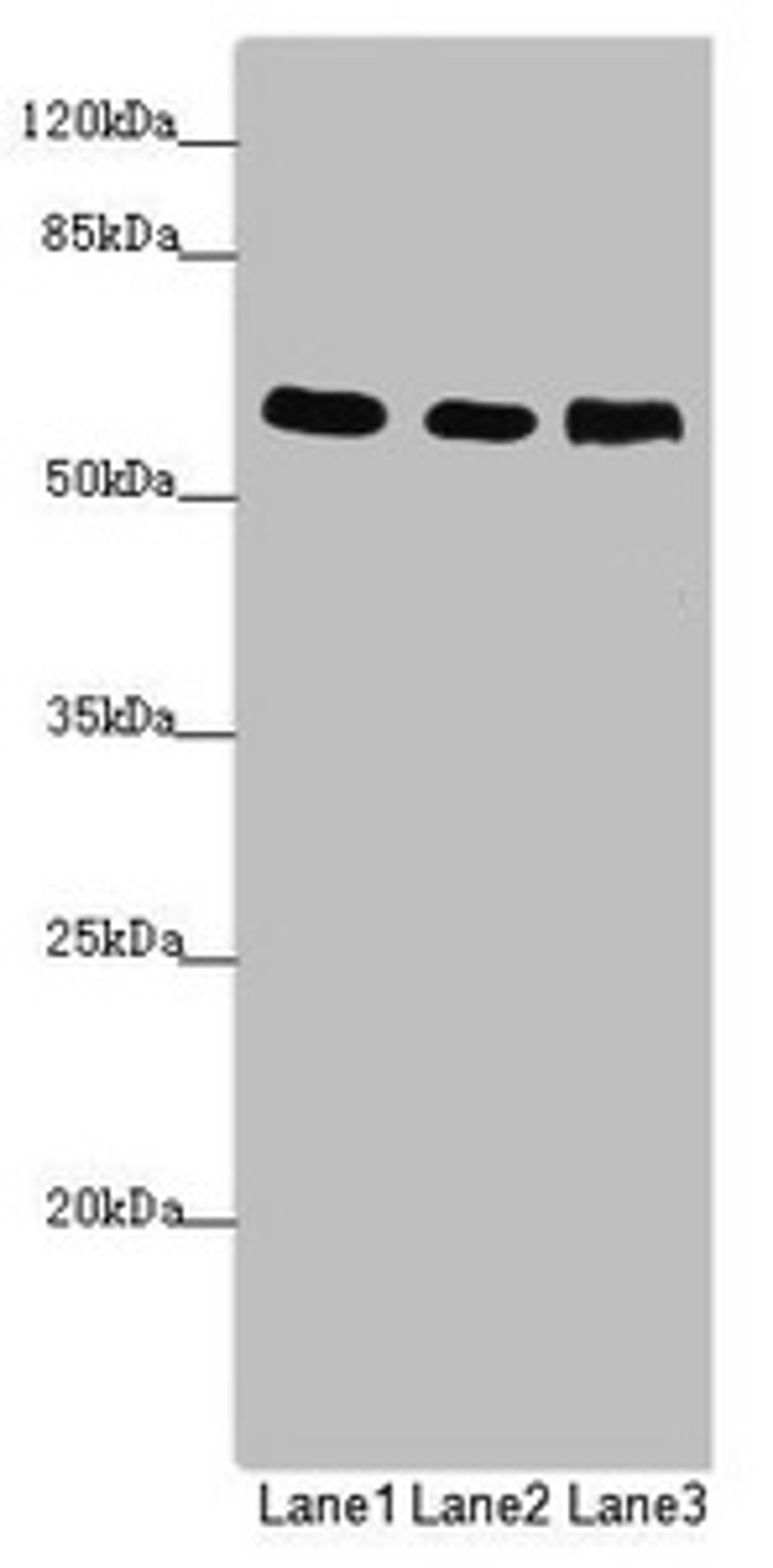 Western blot. All lanes: PRPF4 antibody at 2.87µg/ml. Lane 1: Jurkat whole cell lysate. Lane 2: Hela whole cell lysate. Lane 3: HepG2 whole cell lysate. Secondary. Goat polyclonal to rabbit IgG at 1/10000 dilution. Predicted band size: 59 kDa. Observed band size: 59 kDa