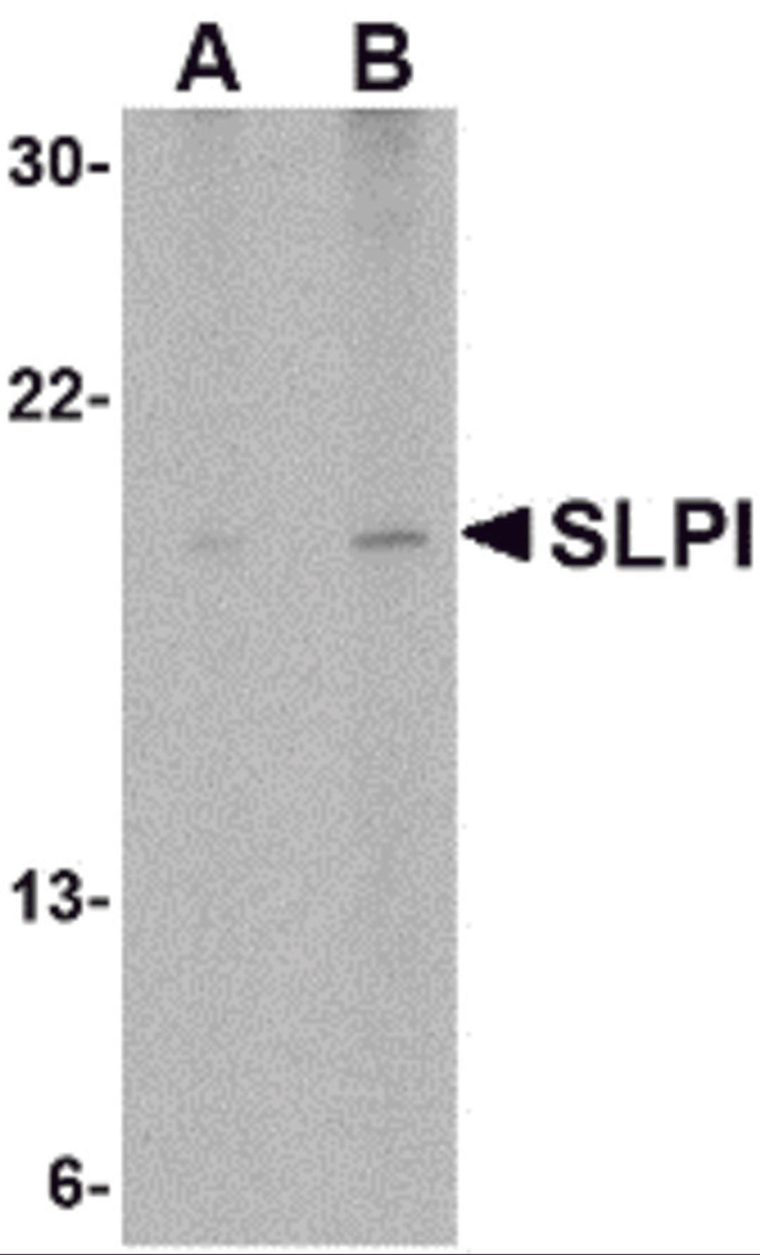 Western blot analysis of SLPI in Daudi cell lysate with SLPI antibody at (A) 1 and (B) 2 &#956;g/mL.