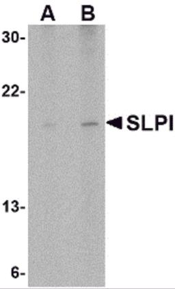 Western blot analysis of SLPI in Daudi cell lysate with SLPI antibody at (A) 1 and (B) 2 &#956;g/mL.