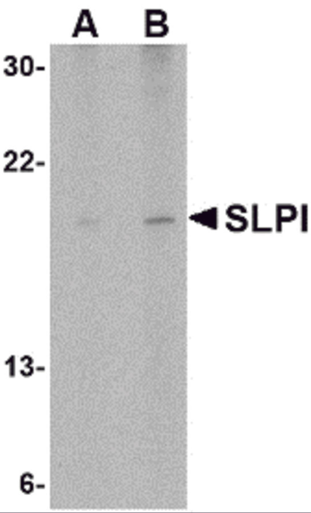 Western blot analysis of SLPI in Daudi cell lysate with SLPI antibody at (A) 1 and (B) 2 μg/mL.