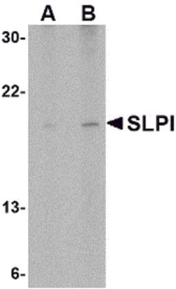 Western blot analysis of SLPI in Daudi cell lysate with SLPI antibody at (A) 1 and (B) 2 μg/mL.