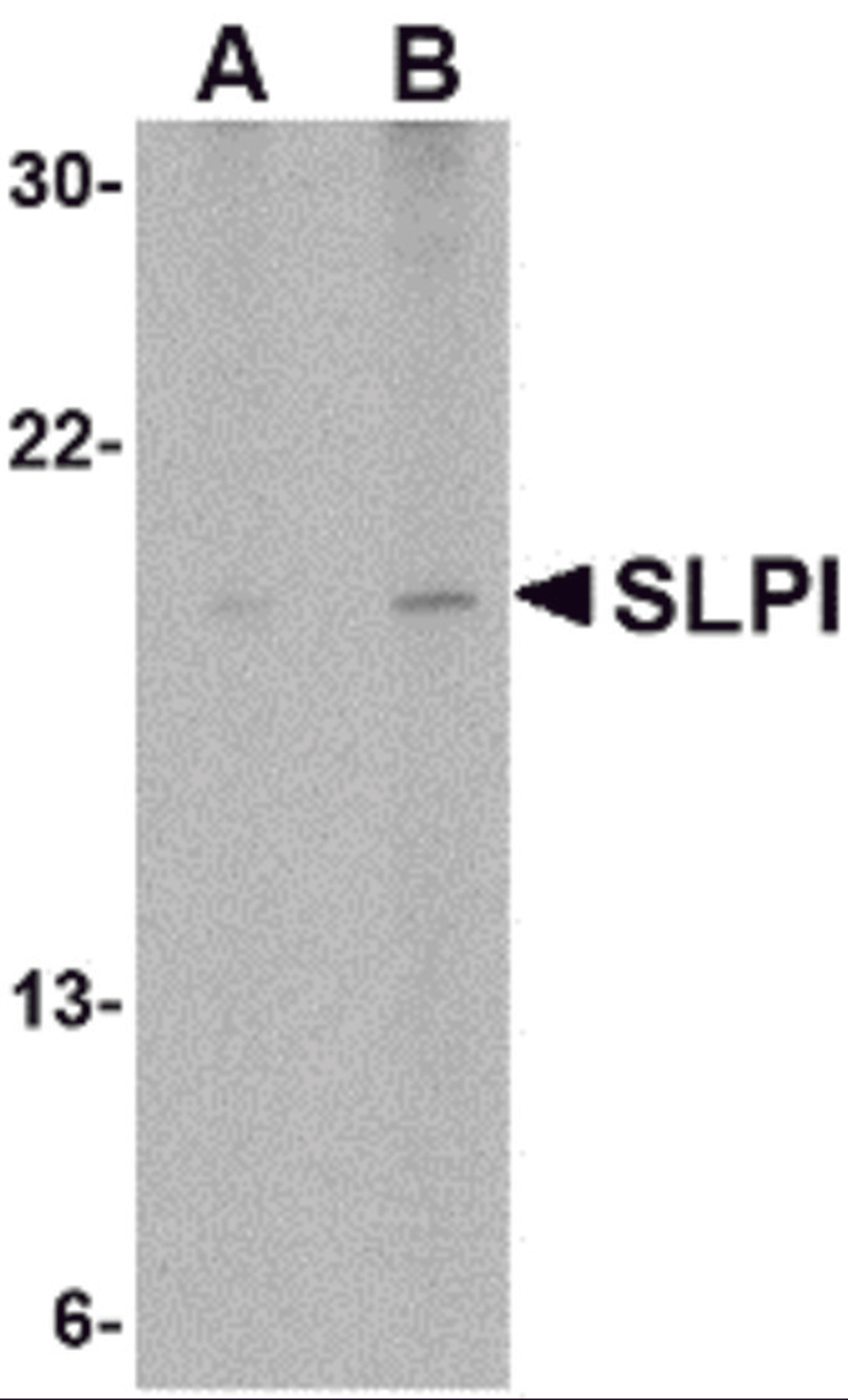 Western blot analysis of SLPI in Daudi cell lysate with SLPI antibody at (A) 1 and (B) 2 μg/mL.