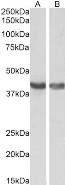 45-727 (0.1ug/ml) staining of Human (A) and Mouse (B) Heart lysates (35ug protein in RIPA buffer). Primary incubation was 1 hour. Detected by chemiluminescence.