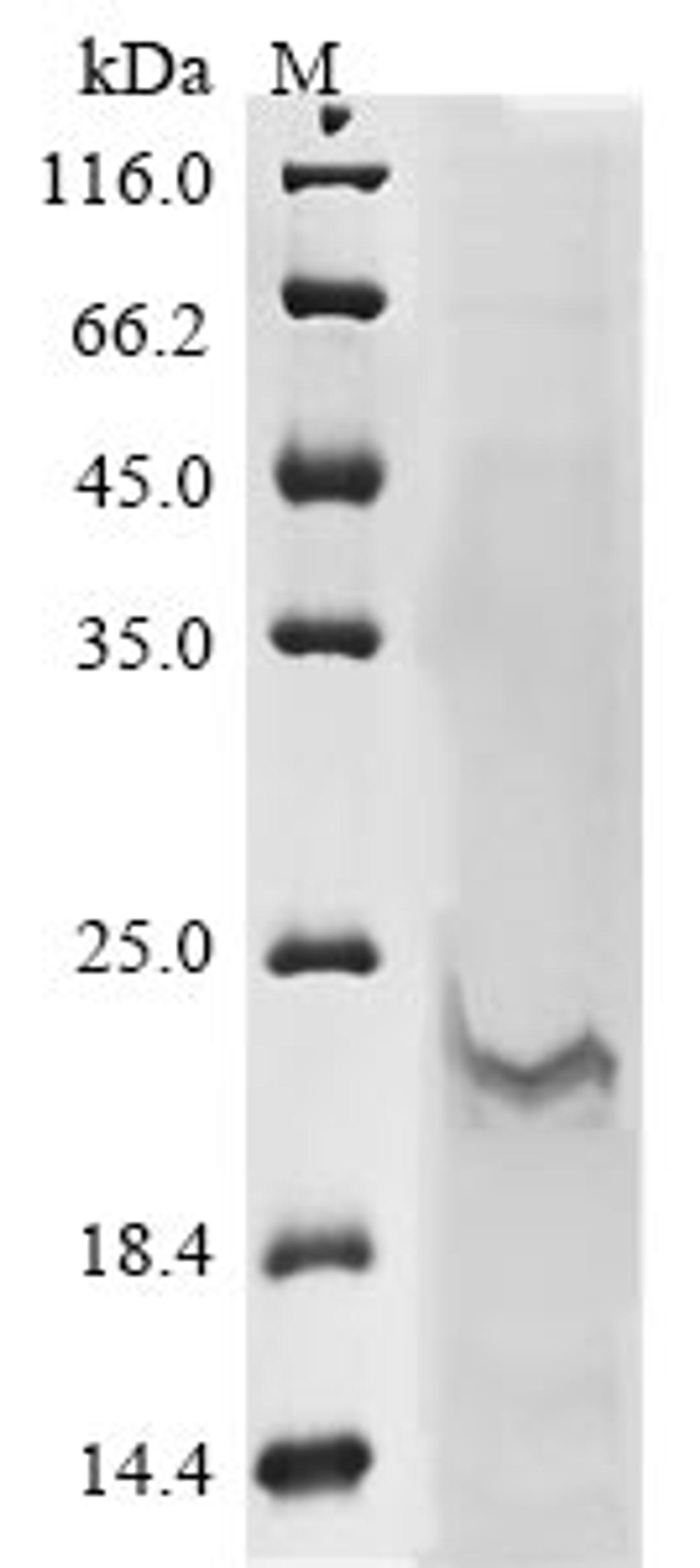 (Tris-Glycine gel) Discontinuous SDS-PAGE (reduced) with 5% enrichment gel and 15% separation gel.