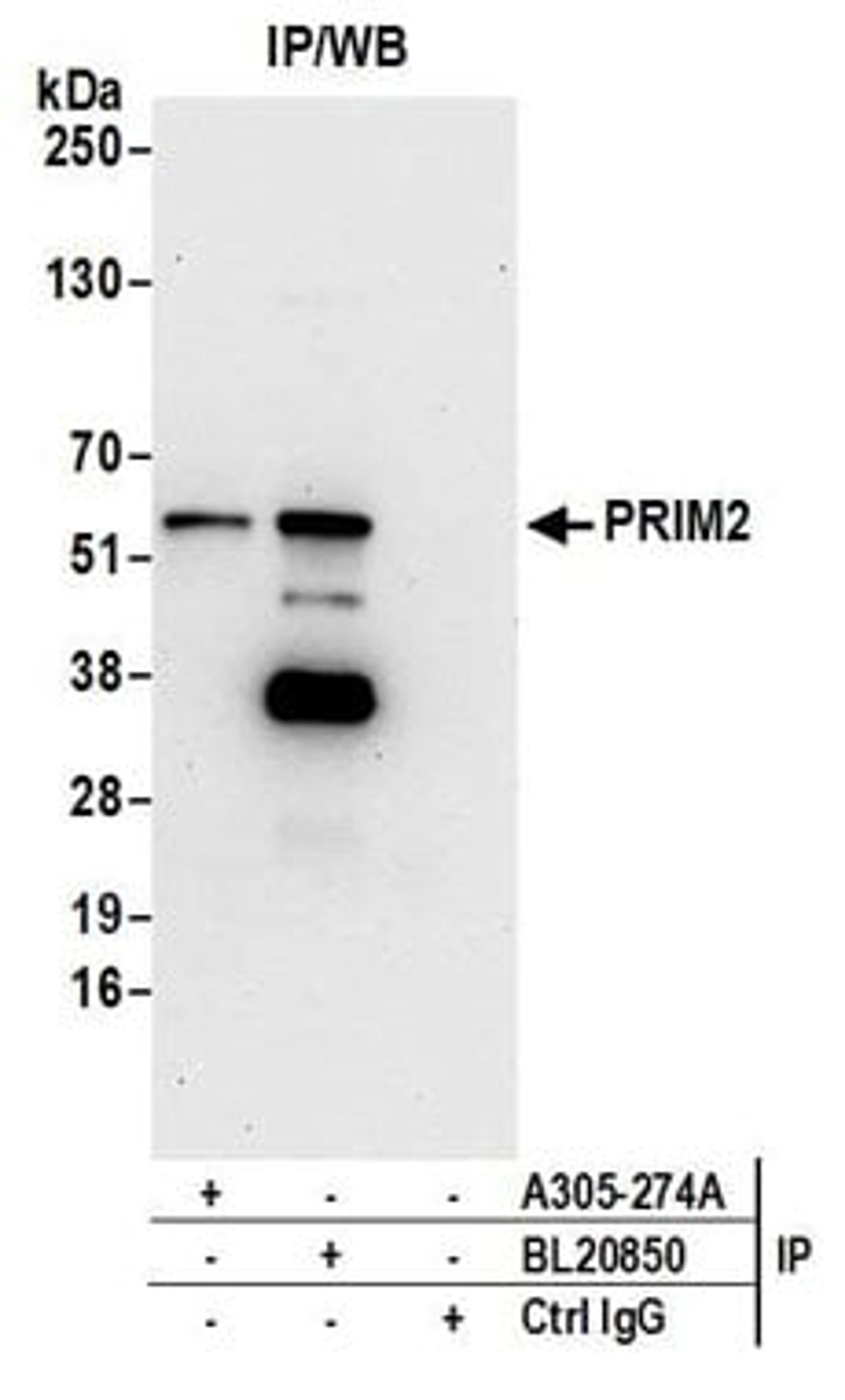 Detection of human PRIM2 by western blot of immunoprecipitates.