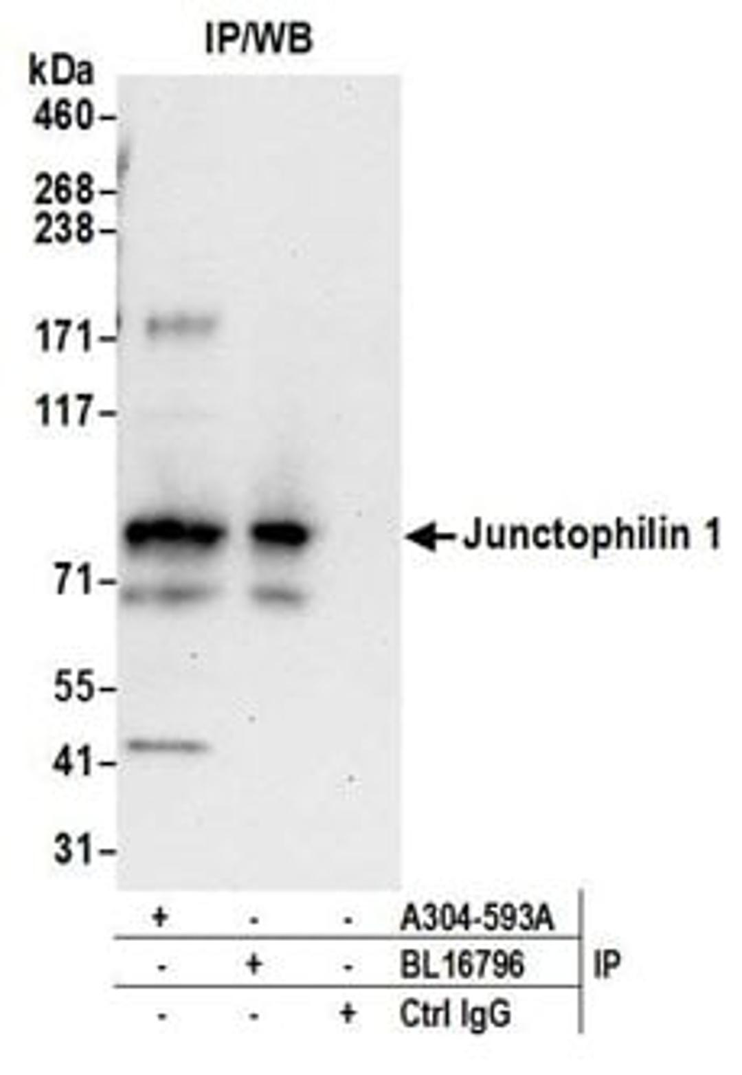 Detection of human Junctophilin 1 by western blot of immunoprecipitates.