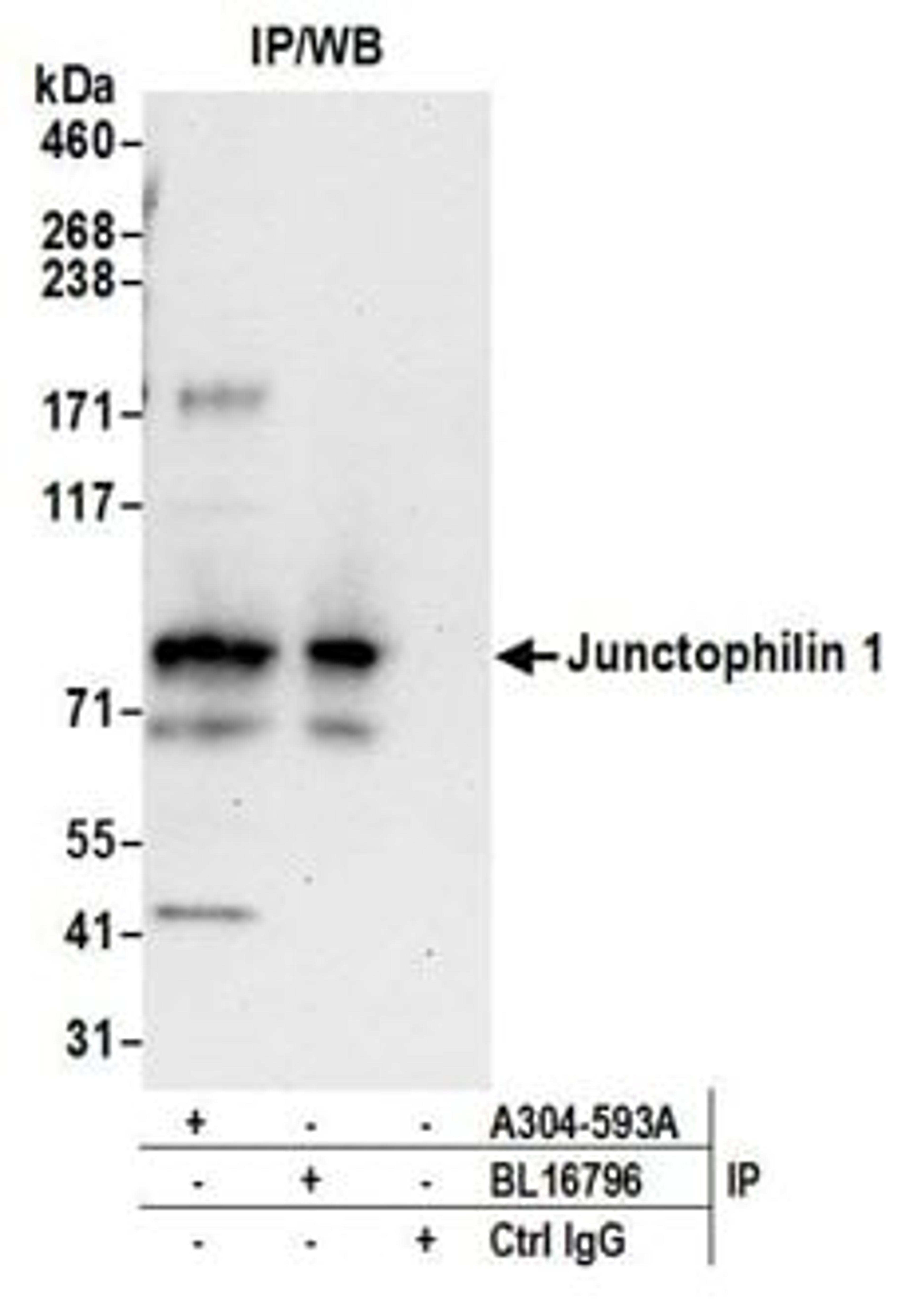 Detection of human Junctophilin 1 by western blot of immunoprecipitates.