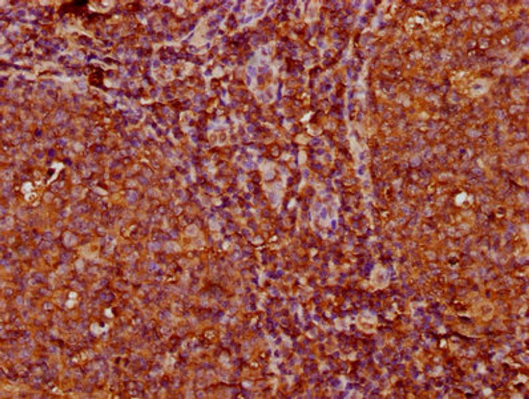 IHC image of CSB-PA011340LA01HU diluted at 1:200 and staining in paraffin-embedded human tonsil tissue performed on a Leica BondTM system. After dewaxing and hydration, antigen retrieval was mediated by high pressure in a citrate buffer (pH 6.0). Section was blocked with 10% normal goat serum 30min at RT. Then primary antibody (1% BSA) was incubated at 4&deg;C overnight. The primary is detected by a biotinylated secondary antibody and visualized using an HRP conjugated SP system.