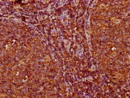 IHC image of CSB-PA011340LA01HU diluted at 1:200 and staining in paraffin-embedded human tonsil tissue performed on a Leica BondTM system. After dewaxing and hydration, antigen retrieval was mediated by high pressure in a citrate buffer (pH 6.0). Section was blocked with 10% normal goat serum 30min at RT. Then primary antibody (1% BSA) was incubated at 4&deg;C overnight. The primary is detected by a biotinylated secondary antibody and visualized using an HRP conjugated SP system.