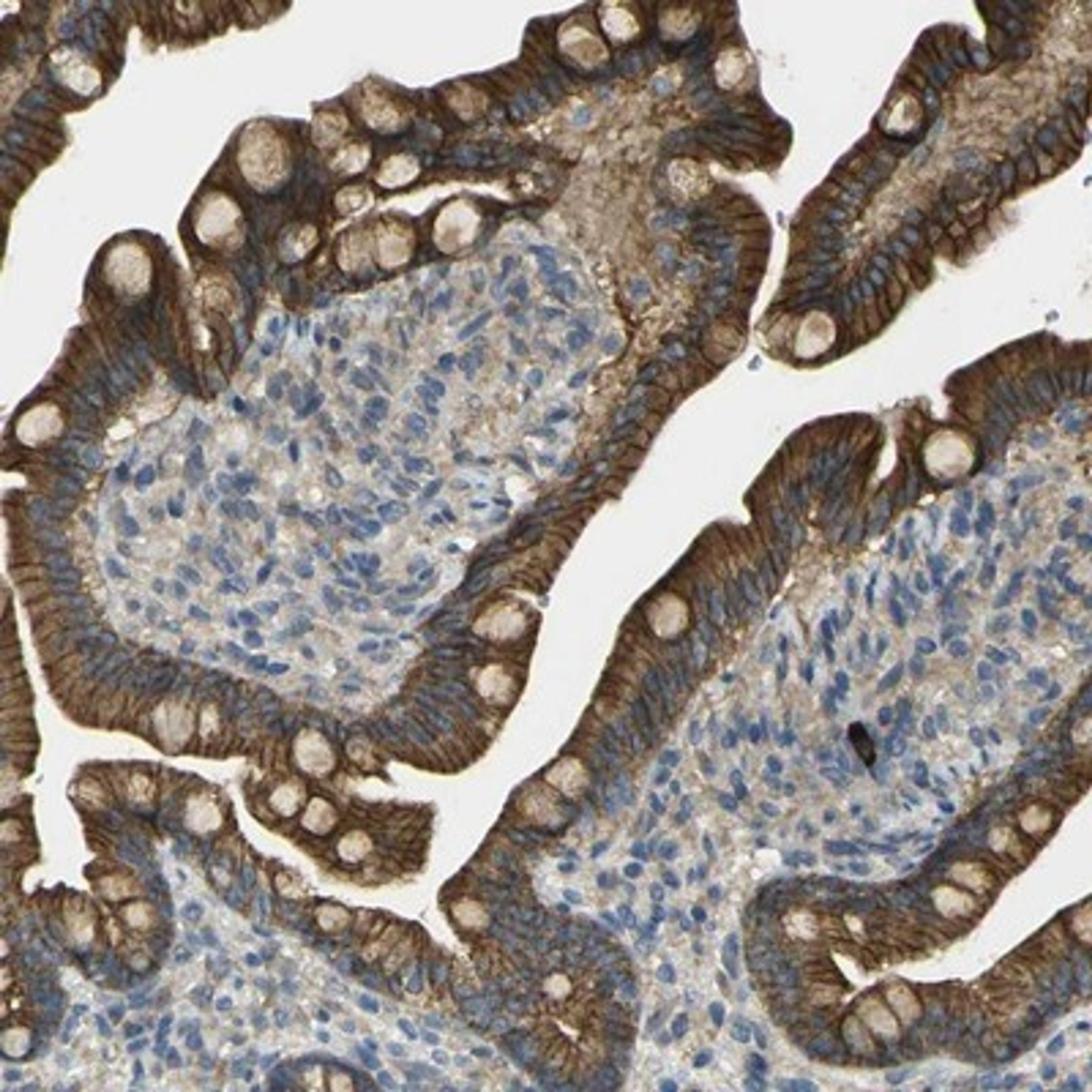 Immunohistochemistry-Paraffin: RHBDD1 Antibody [NBP1-85092] - Staining of human small intestine shows strong cytoplasmic and membranous positivity in glandular cells.