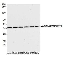 Detection of human STING/TMEM173 by WB.