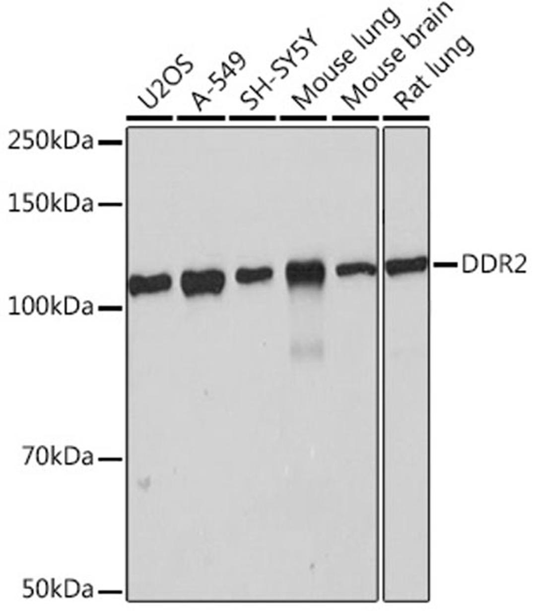 Western blot - DDR2 Rabbit mAb (A4296)