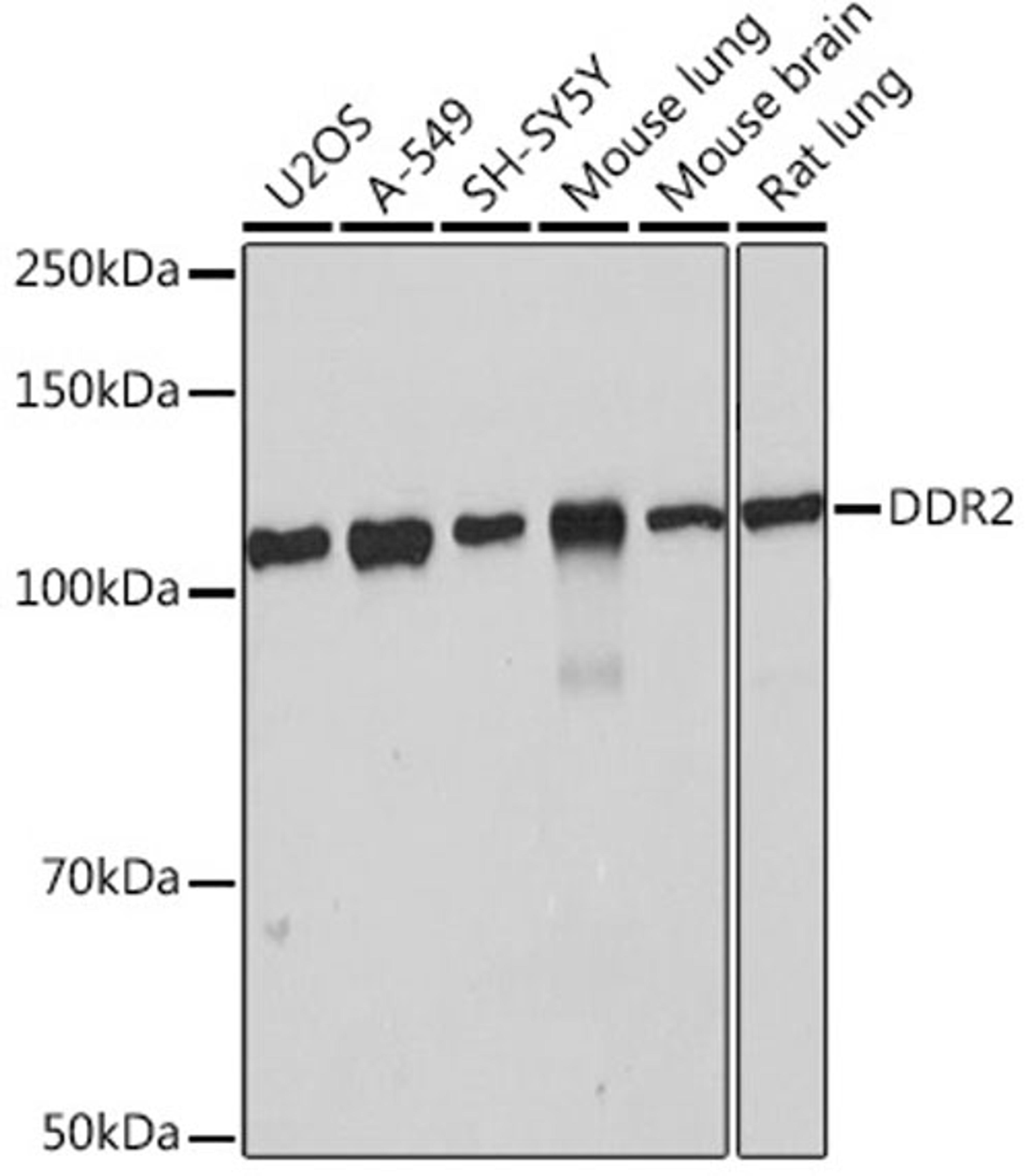 Western blot - DDR2 Rabbit mAb (A4296)