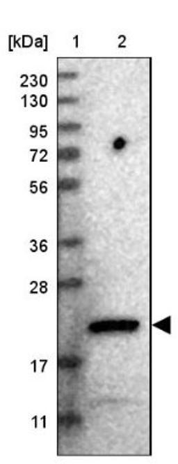 Western Blot: CCDC25 Antibody [NBP1-83821] - Lane 1: Marker [kDa] 230, 130, 95, 72, 56, 36, 28, 17, 11<br/>Lane 2: Human cell line RT-4