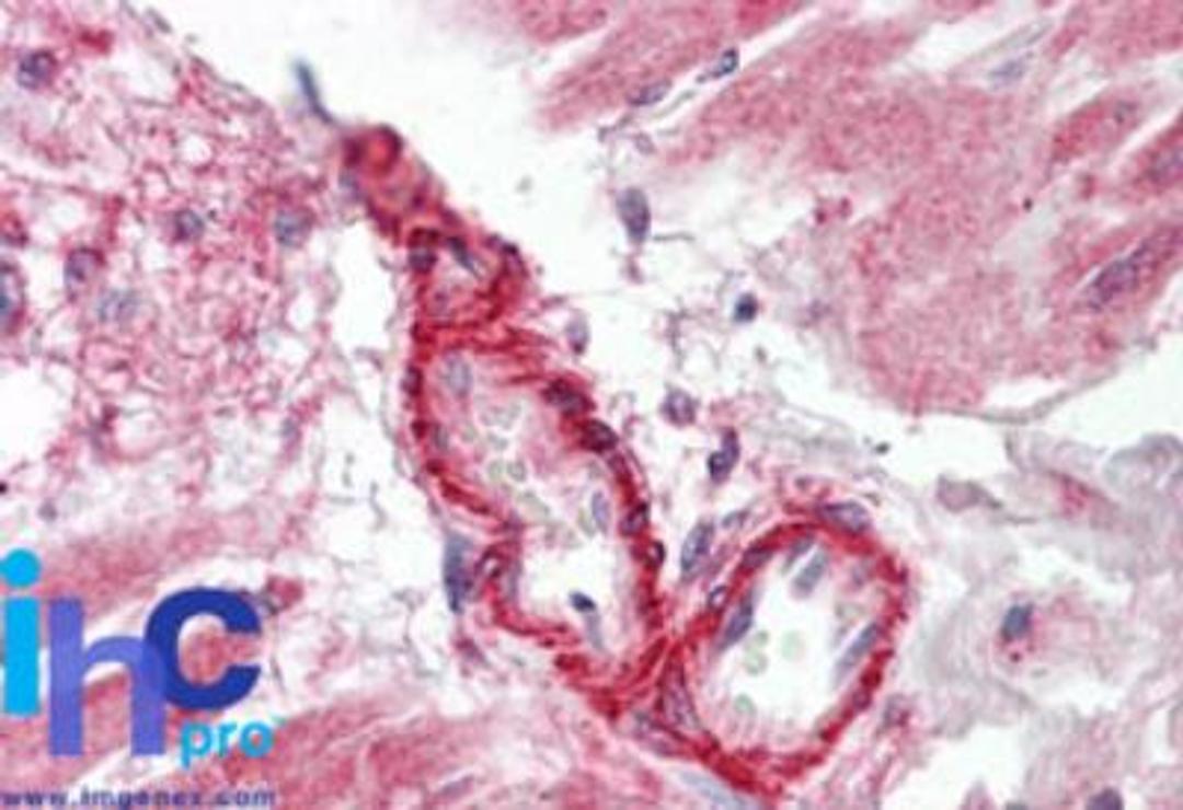 Immunohistochemistry-Paraffin: Flightless I Antibody [NBP2-24584] - Formalin-fixed, paraffin-embedded human heart probed with FLII antibody at 5 ug/ml.    Staining of formalin-fixed tissues is enhanced by boiling tissue sections in 10 mM sodium citrate buffer, pH 6.0 for 10-20 min followed by cooling at RT for 20 min.